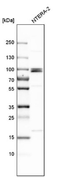 MCPH1 Antibody, Novus Biologicals 0.1mL; Unlabeled:Antibodies, Polyclonal